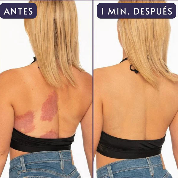 EELHOE™ Corrector Hidratante corporal