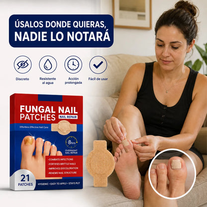 DermaPatch Pro™ Parches antifúngico para hongos (21 Unidades) 🦶